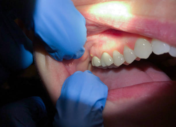 Best Emergency Dental Surgery in Vergennes, VT